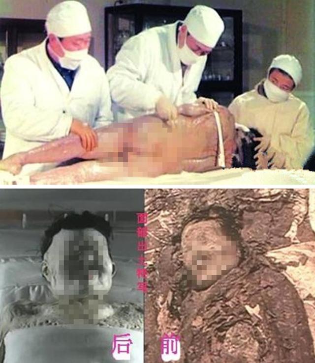 最新女性尸检图片大全,细致呈现,深入解析