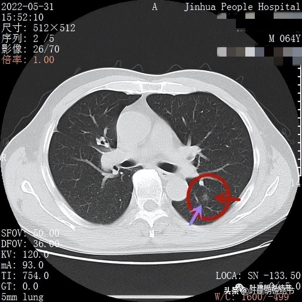 中国今日最新病例,了解与应对的详细步骤指南(初学者/进阶用户适用)