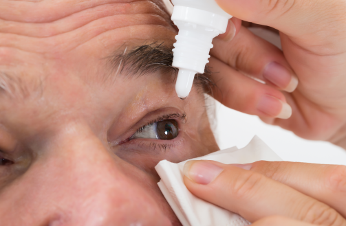 干眼症最新消息,科技革新,为你的眼睛保驾护航