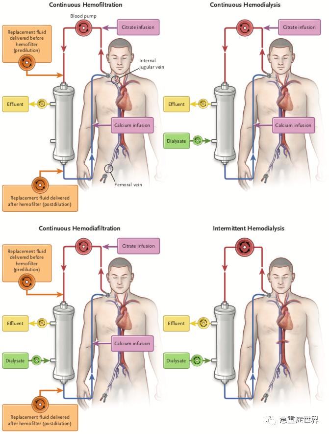 万能猪人工肾最新消息,制作指南与技能学习