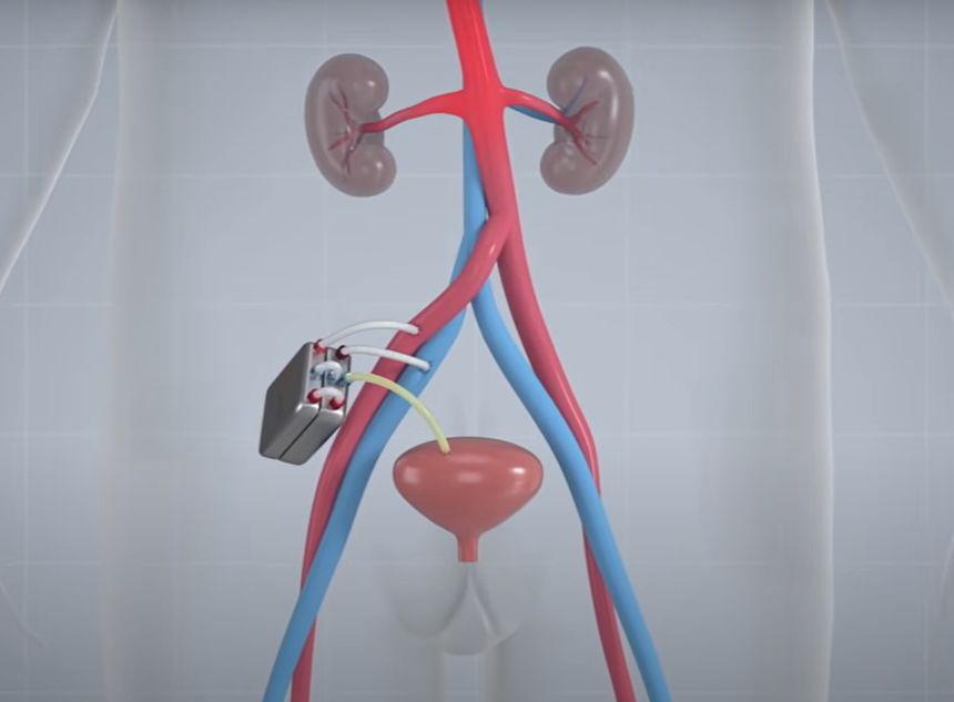 万能猪人工肾最新消息,制作指南与技能学习